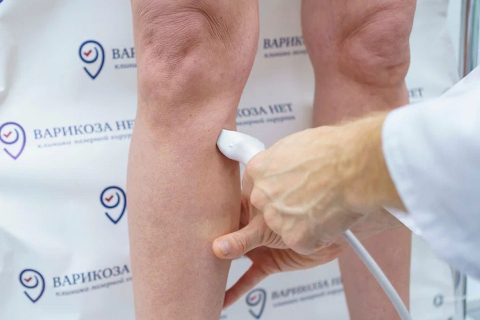 Почему гормональные изменения могут влиять на вены