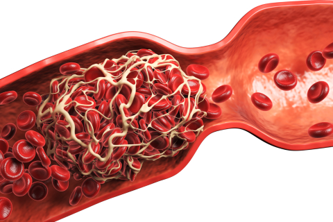 Скидка 40% на комплекс 'Профилактика тромбоза'