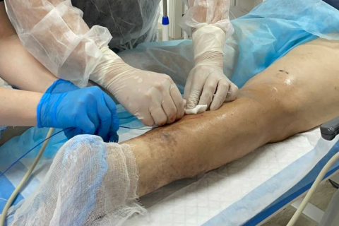 Трофическая язва при варикозе: как остановить и вылечить без операции